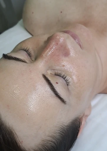 Dermaplaning ⭐⭐⭐⭐⭐